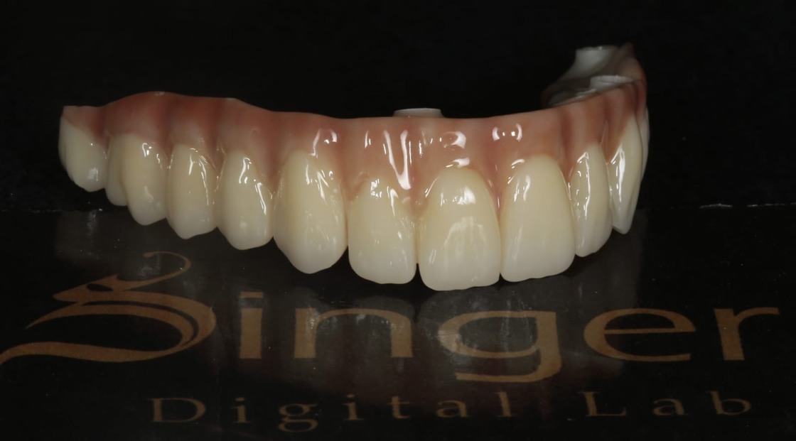 Yucera 4D Pro Dental Ceramic Blocks Quality and Precision