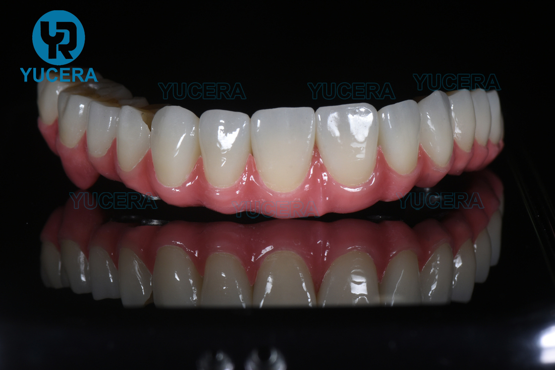 YUCERA Οδοντιατρική Μηχανή Μύλου CAD CAM και Κατασκευαστής Οδοντιατρικών Υλικών και Εξοπλισμού CAD CAM, Μηχανή Μύλου Οδοντιατρικού Εργαστηρίου