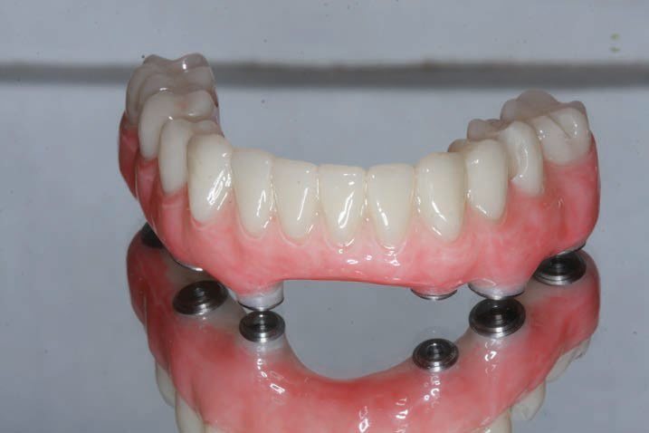 Yucera Cad Cam Multi Pmma Δίσκος Οδοντιατρικό Υλικό Pmma Blocks Οδοντιατρικός Δίσκος Ζιρκονίας Εύκαμπτα Pmma Resin Blocks