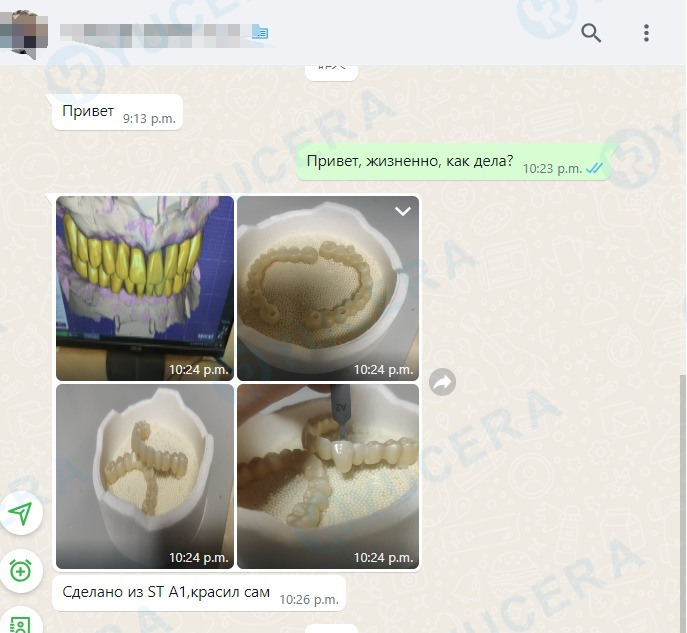 Yucera 4D Pro 95mm Οδοντιατρικό Μπλοκ Ζιρκονίας Ακριβείς Διαστάσεις Κατάλληλο για Ποικιλία Οδοντιατρικών Αποκαταστάσεων