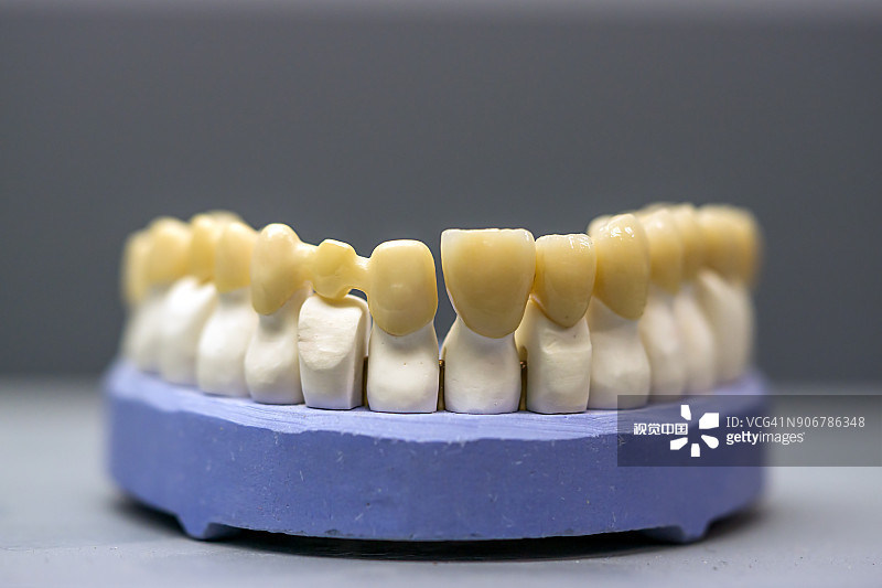 Yucera STwhite Dental Zirconia Discs - The Ideal Complement to Our Top - Notch Blocks
